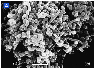 図２:歯肉縁下プラークにおける細菌叢の遷移（走査電子顕微鏡写真）A