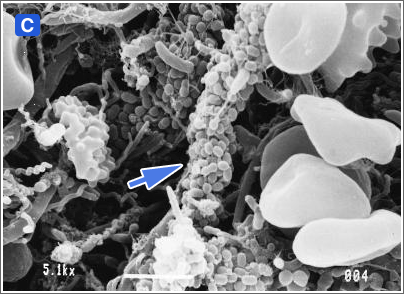 図２:歯肉縁下プラークにおける細菌叢の遷移（走査電子顕微鏡写真）C