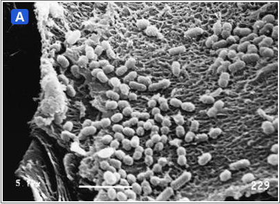 図6:	口腔粘膜に付着した口腔細菌A