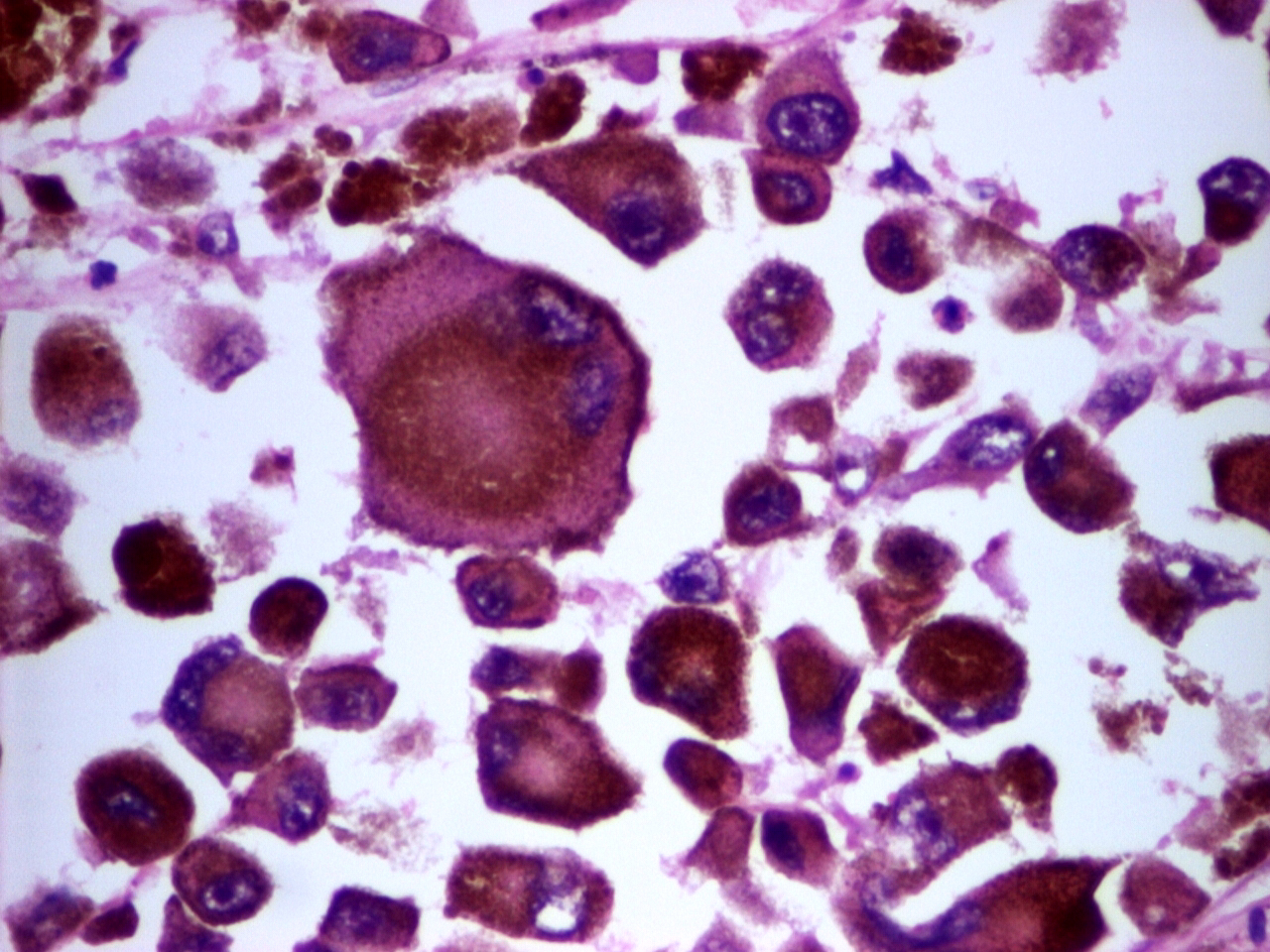 ステージと生存